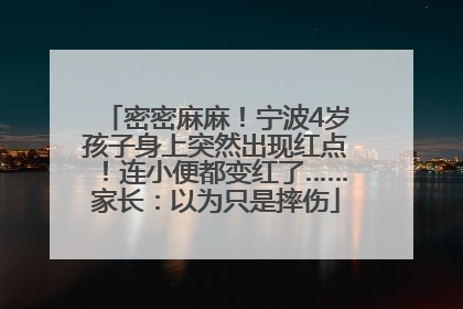 密密麻麻！宁波4岁孩子身上突然出现红点！连小便都变红了……家长：以为只是摔伤